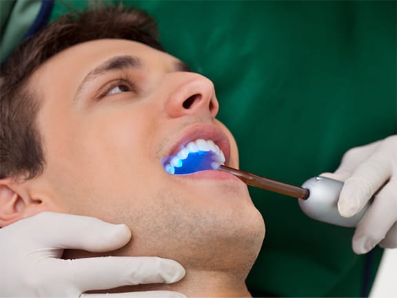 ZOOM Whitening